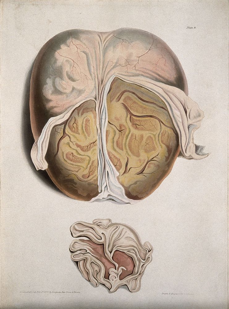A dissected brain; and a section of a child's brain. Coloured aquatint by C. J. Canton for Richard Bright, 1829.