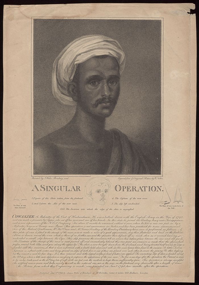 Cowasjee, a man who had his nose reconstructed with the aid of plastic surgery. Stipple engraving by W. Nutter, 1795, after…