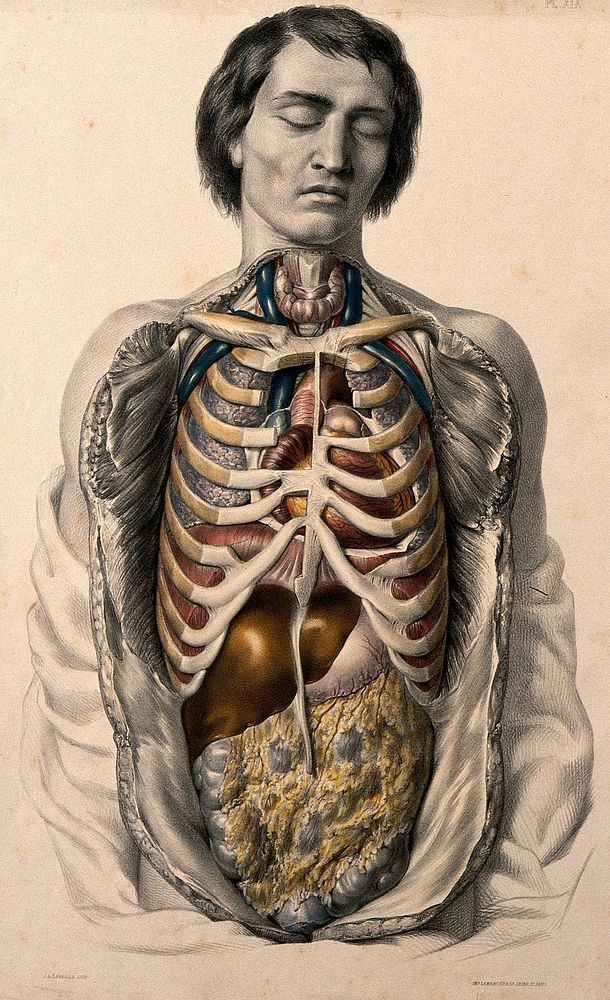 The body of a man with his trunk dissected to reveal the ribs and viscera. Coloured lithograph by J.B. Léveillé after…