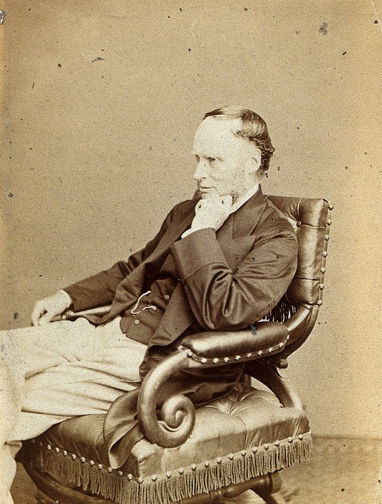 Thomas Pridgin Teale. Photograph by Ernest Edwards, 1867.