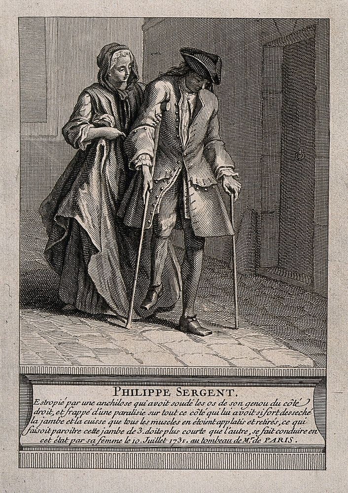 Philippe Sergent, suffering from ankylosis of the left leg, walking to the tomb of François de Paris, with crutches and…