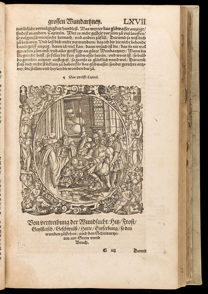 Opus chyrurgicum, des weitberumbten Hochgelehrten und Erfarnen / Aureoli Theophrasti Paracelsi ... Wund und Artzney Buch.…