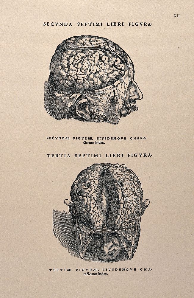 The brains of dissected heads. Photolithograph, 1940, after a woodcut, 1543.