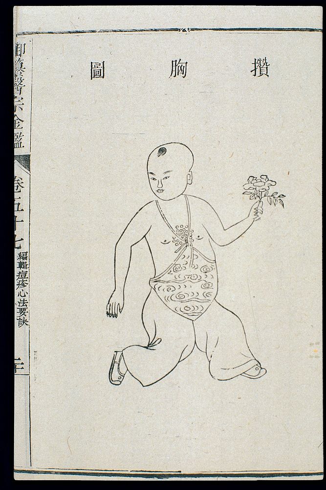 Chinese C18: Paediatric pox - 'Gathered on the Breast' pox