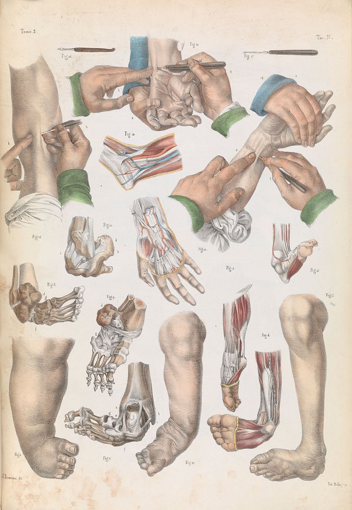 Iconografia d'anatomia chirurgica e di medicina operatoria / [Jean Baptiste Marc Bourgery].