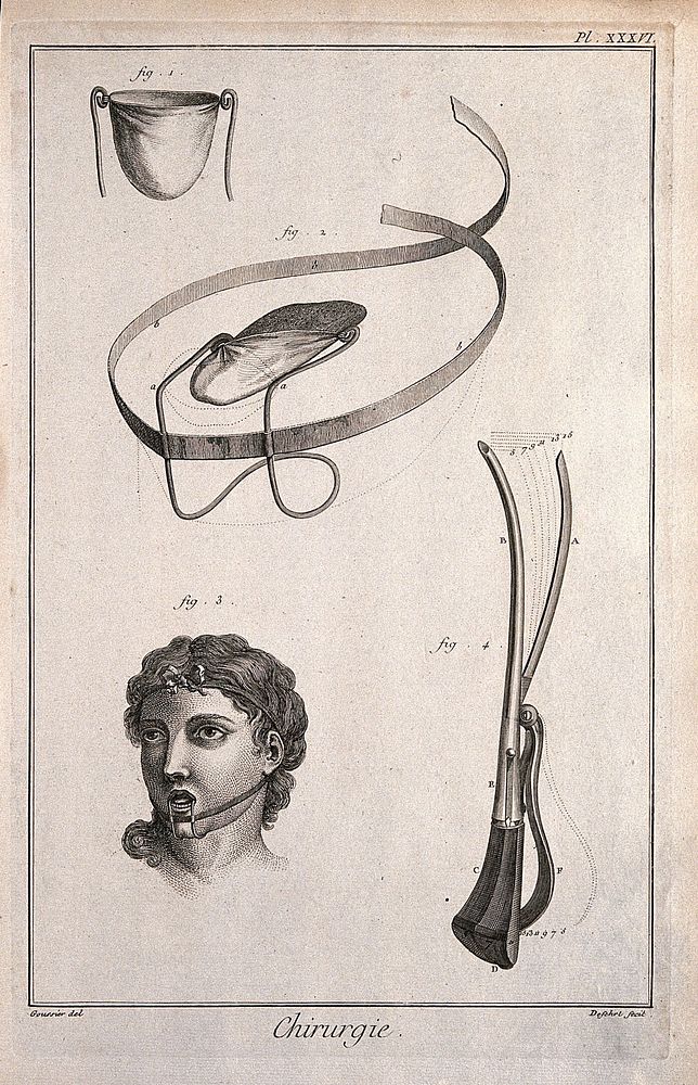 Surgery: surgical instruments, including a bandage for the tongue. Engraving with etching by A.J. Defehrt after L.-J.…