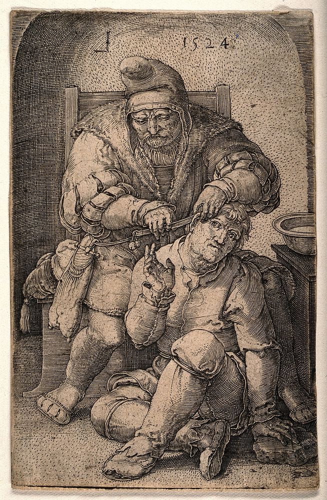 An itinerant surgeon extracting stones from a man's head; symbolising the expulsion of 'folly' (insanity) Line engraving by…
