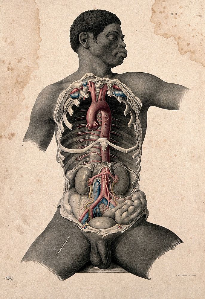 Dissection of the trunk of a seated black man, showing major blood-vessels. Coloured lithograph by J. Maclise, 1851.