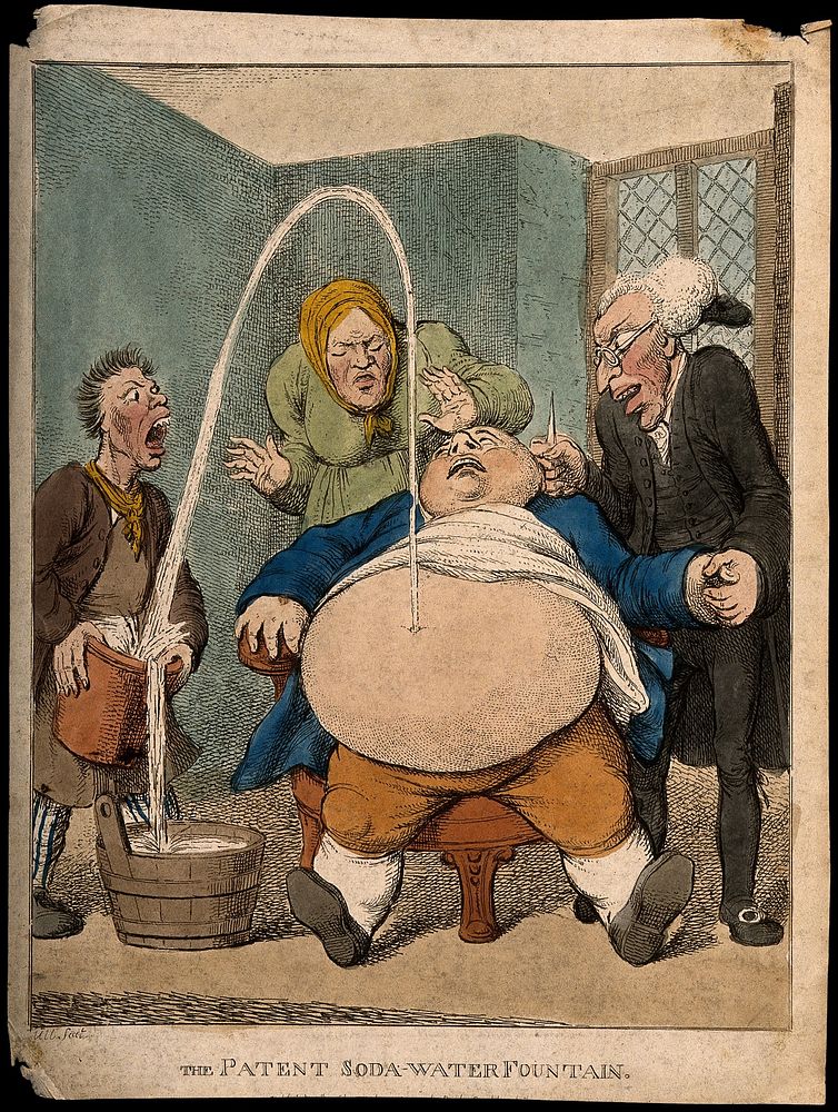 A doctor performing a paracentesis on an obese man, whose abdomen is tapped ejecting a fountain into a bucket. Coloured…