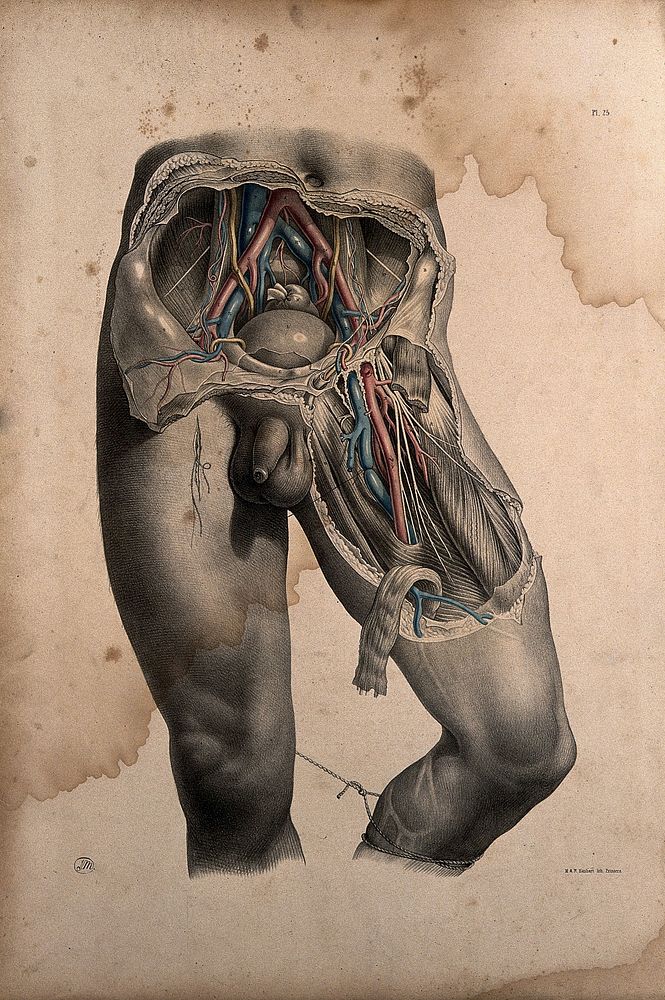 Dissection of the abdomen and thigh of a standing man, showing major blood-vessels. Coloured lithograph by J. Maclise, 1851.