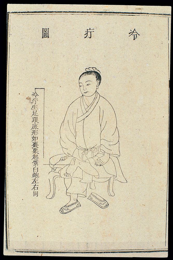 Chinese C18 woodcut: External medicine - Cold boil