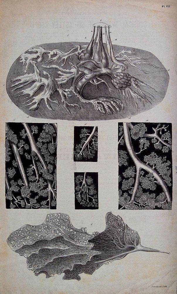 Anatomical structures: six figures. Lithograph by Sinclair's.
