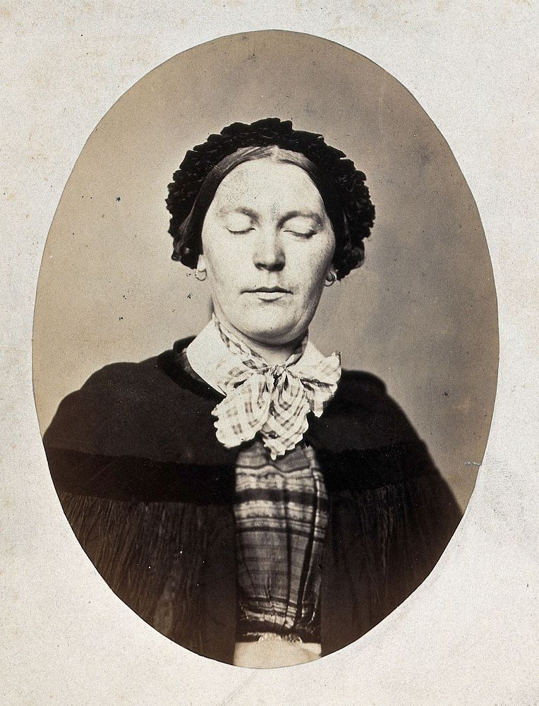 A woman's head and shoulders; her eyes are closed and her mouth shows a slight grimace. Photograph by L. Haase after H.W.…