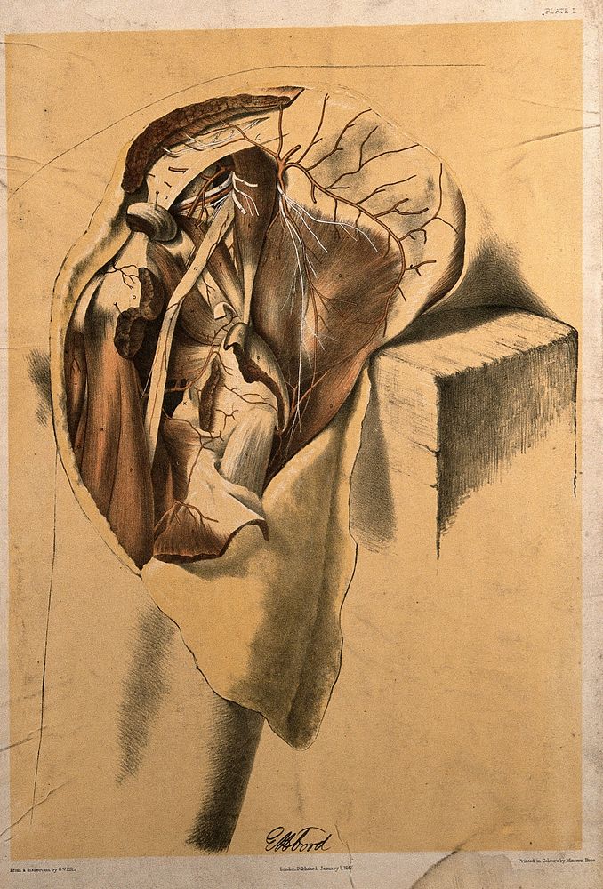 Dissection of the hip, upper thigh and buttock of a man, showing the muscles and blood vessels. Colour lithograph by G.H.…