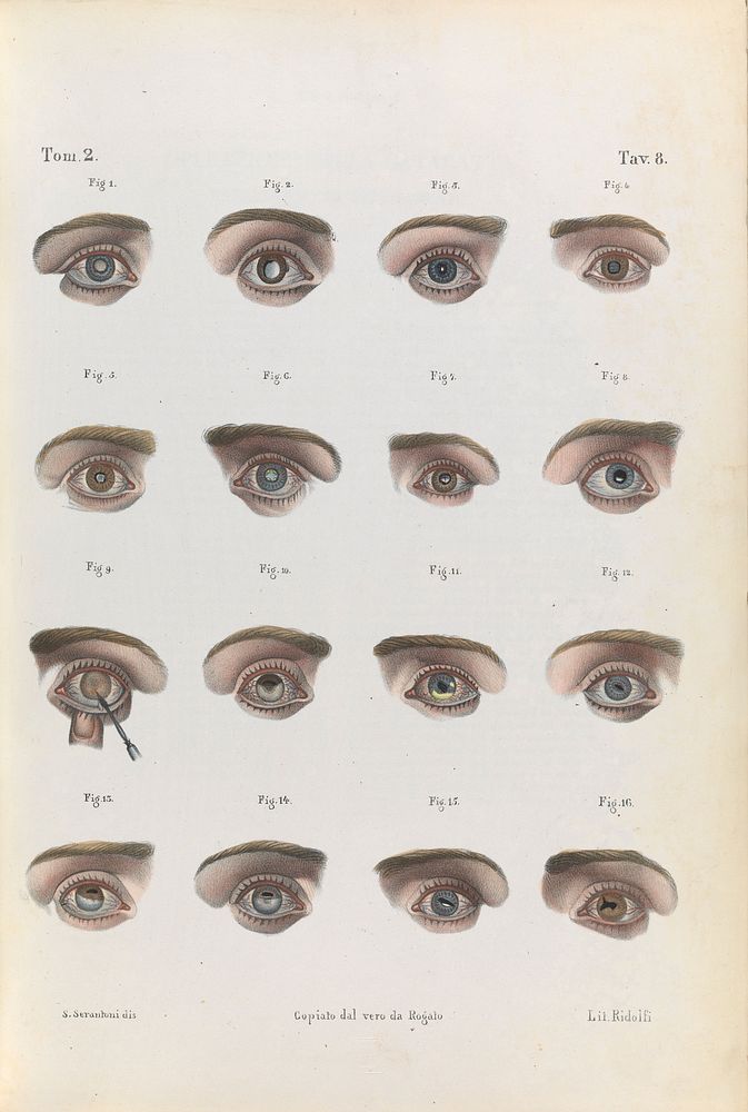 Plate 8. Illustration of various eye diseases