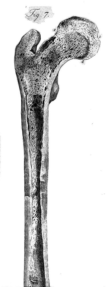 Tabulae anatomicae / quas ad illustrandam humani corporis fabricam collegit et curavit J.C. Loder.