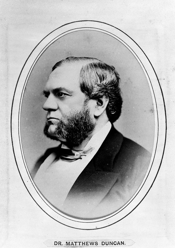 James Matthews Duncan. Photograph by G. Jerrard, 1881.