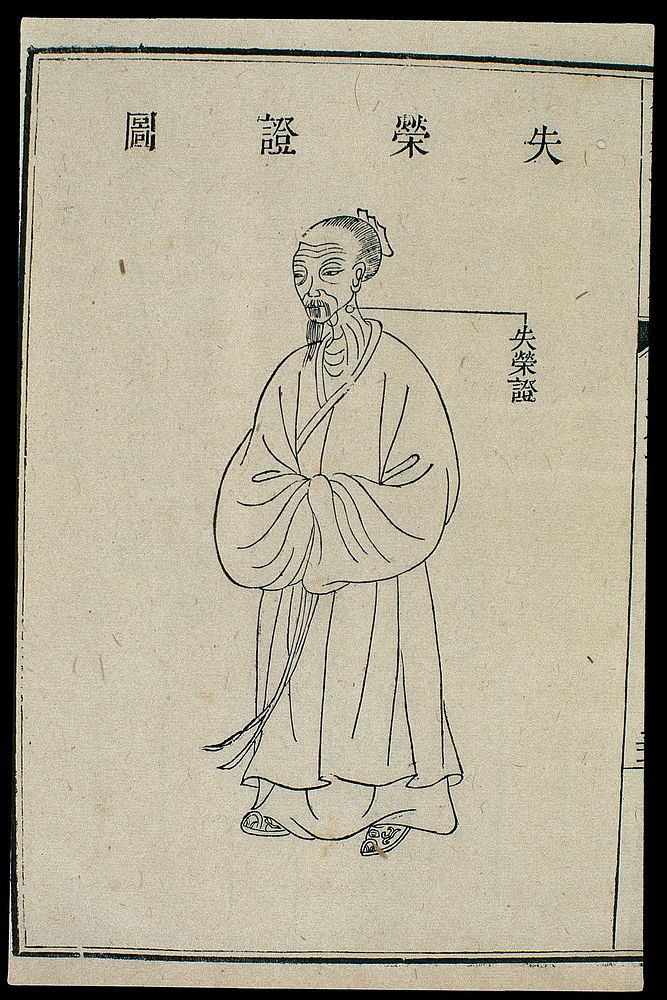 Chinese C18 woodcut: External medicine - Tumour on the neck