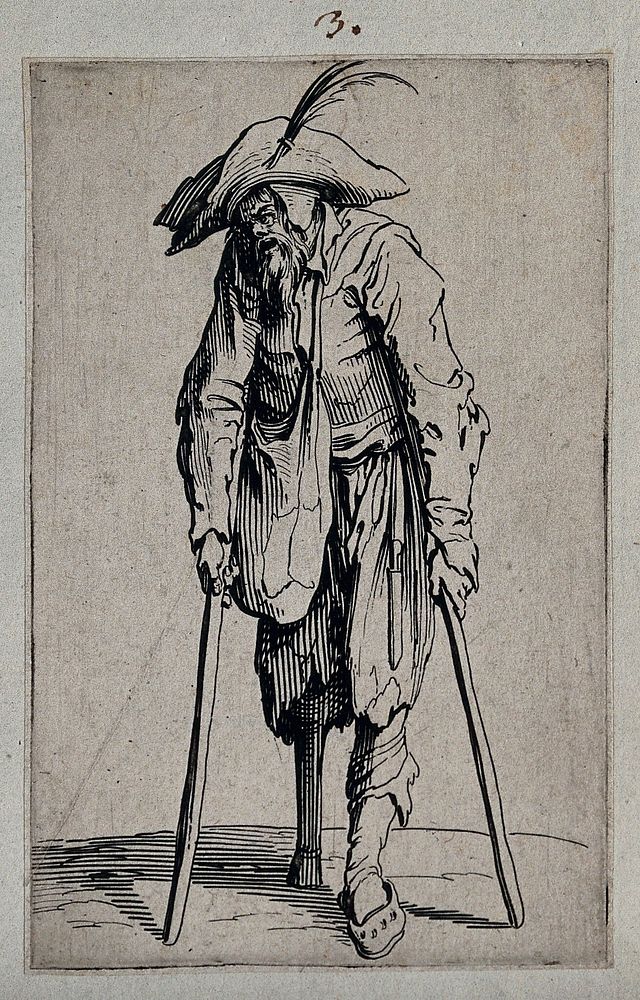 Beggar with a wooden leg. Etching with engraving by Jacques Callot, ca. 1622.