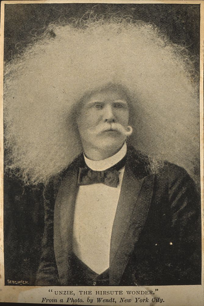 Unzie, an albino Aboriginal man with an abundance of white hair. Reproduction by Sedgwick after a photograph by Wendt, late…