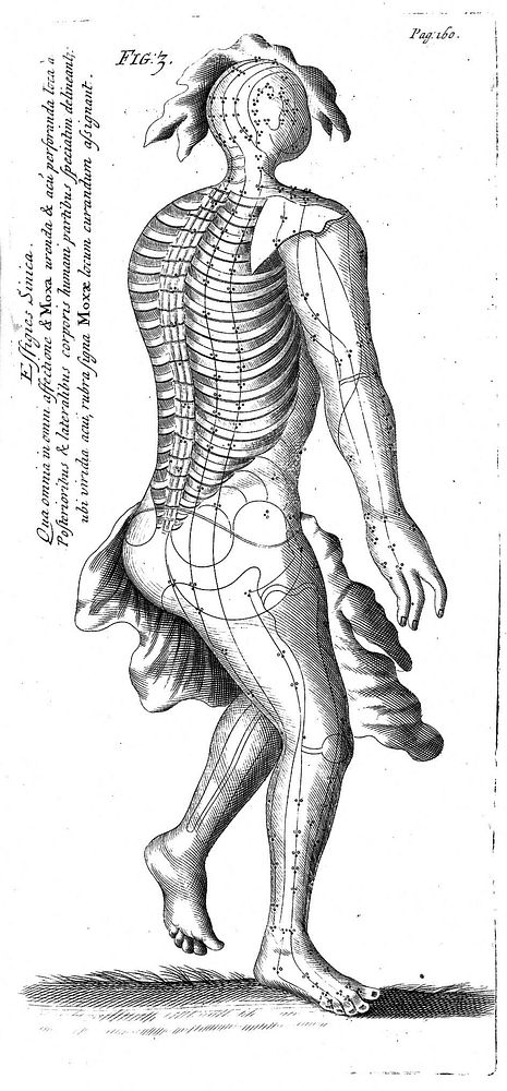 Transisalano-Daventriensis Dissertatio de arthritide: mantissa schematica: de acupunctura: et orationes tres, I. De chymiae…