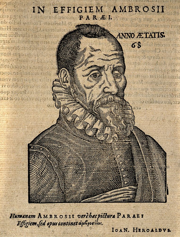 Ambroise Paré. Woodcut, 1612.