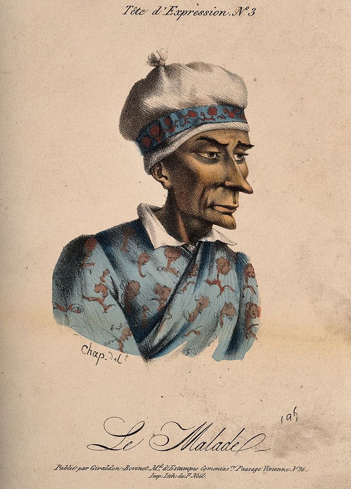 A sick man. Coloured lithograph by Chap .