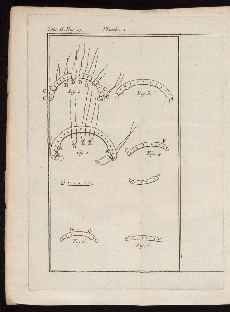 Dental prosthetics, M. Bourdet, 18th century.