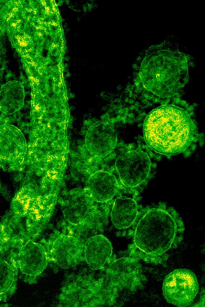 Green coronavirus under a microscope.