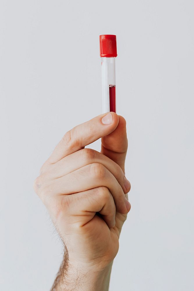 Hand holding a blood test tube 