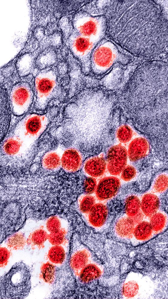 Novel Coronavirus SARS-CoV-2 electron micrograph