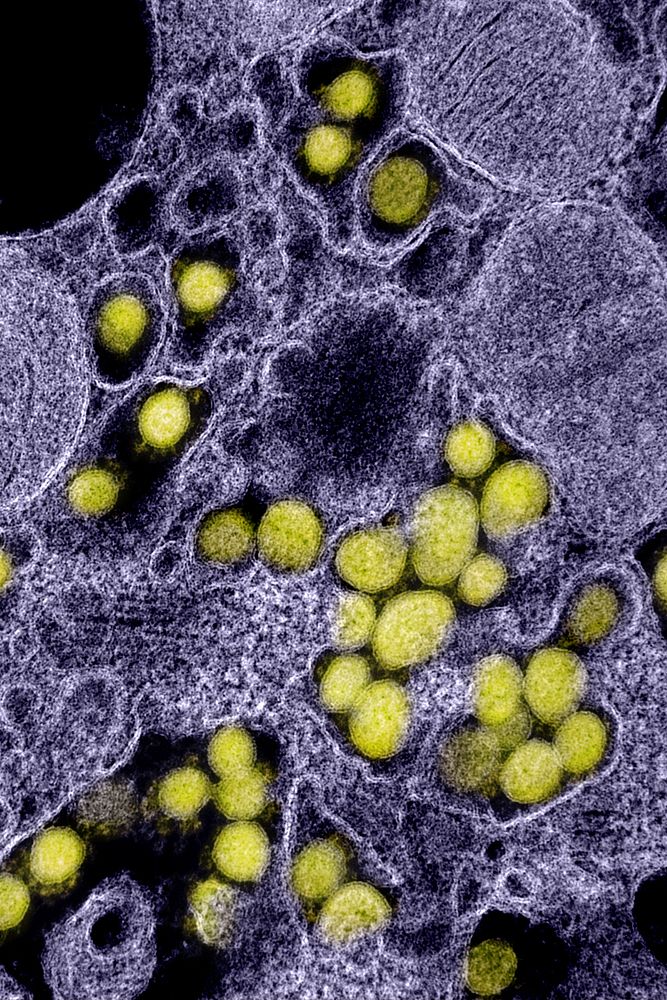 Novel Coronavirus SARS-CoV-2 electron micrograph