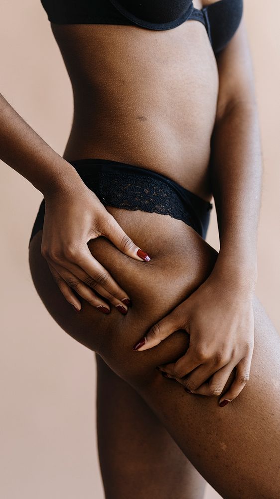 Black woman with a leg skin problem mobile phone background