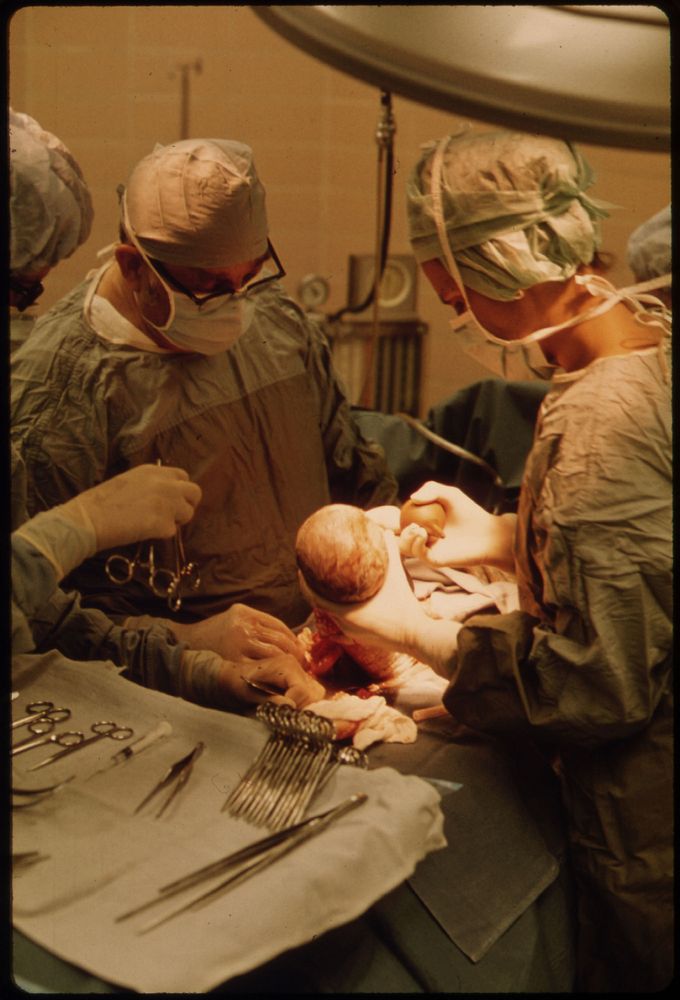 Dr. Howard Vogel, Left, Is Assisted by His Daughter, Dr. Ann Vogel, as They Perform the Last Caesarean Section of a New-Born…