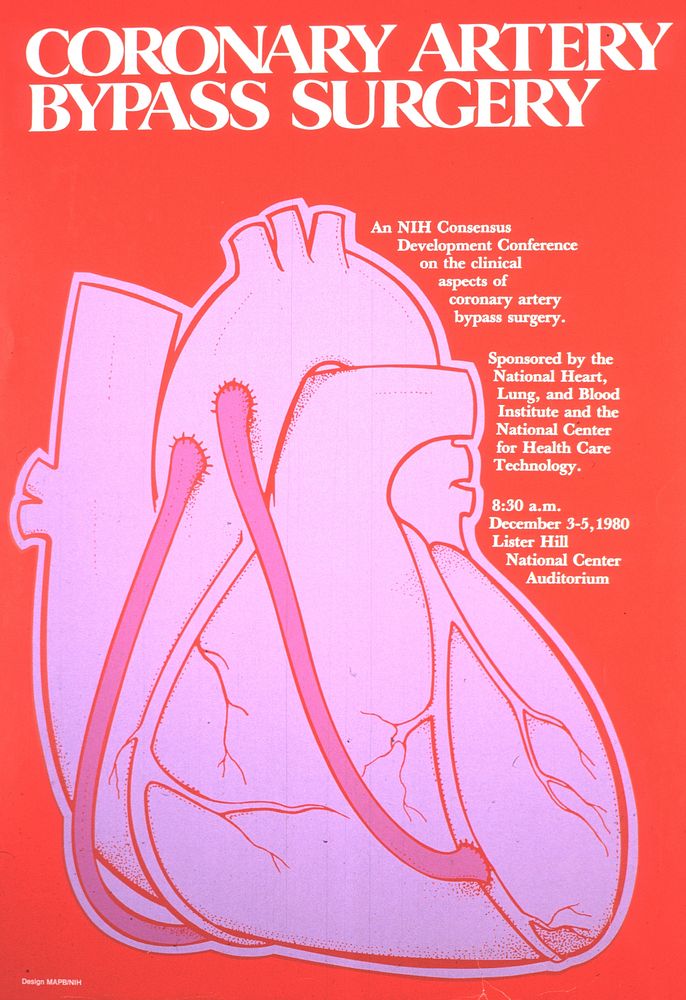 Coronary artery bypass surgery poster.