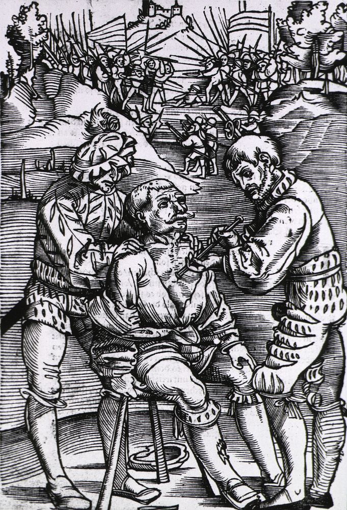 Military surgeon treats battle woundAuthor(s): Gersdorff, Hans von, -1529., author Publication: Strassburg: Joannem Schott…