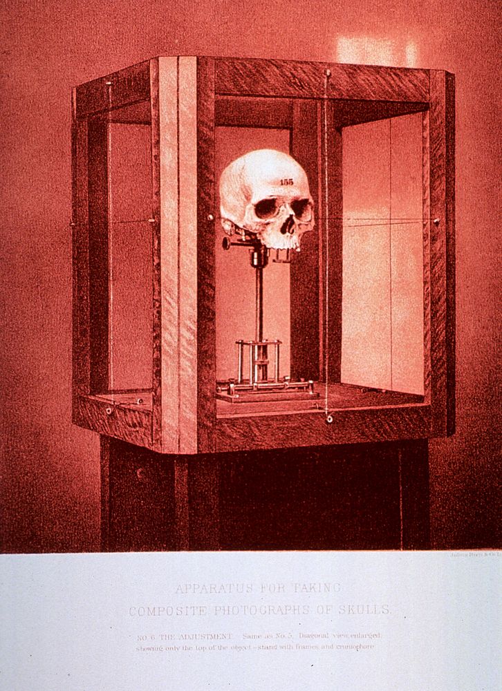 Apparatus for Taking Composite Photographs of Skulls: No. 6.