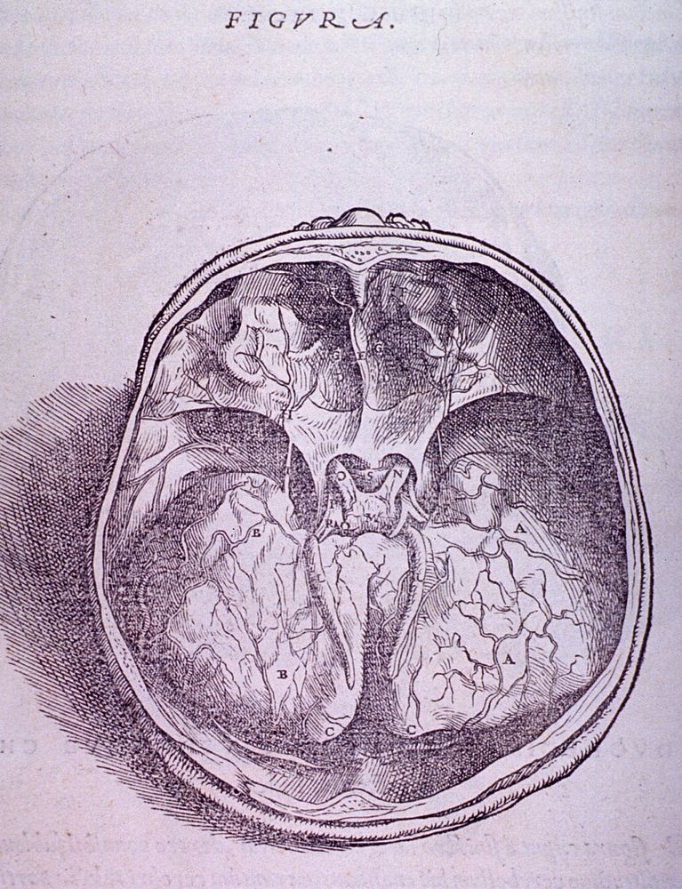 Brain PlateCollection: Images from the History of Medicine (IHM) Format: Still image Subject(s): Brain Genre(s): Book…