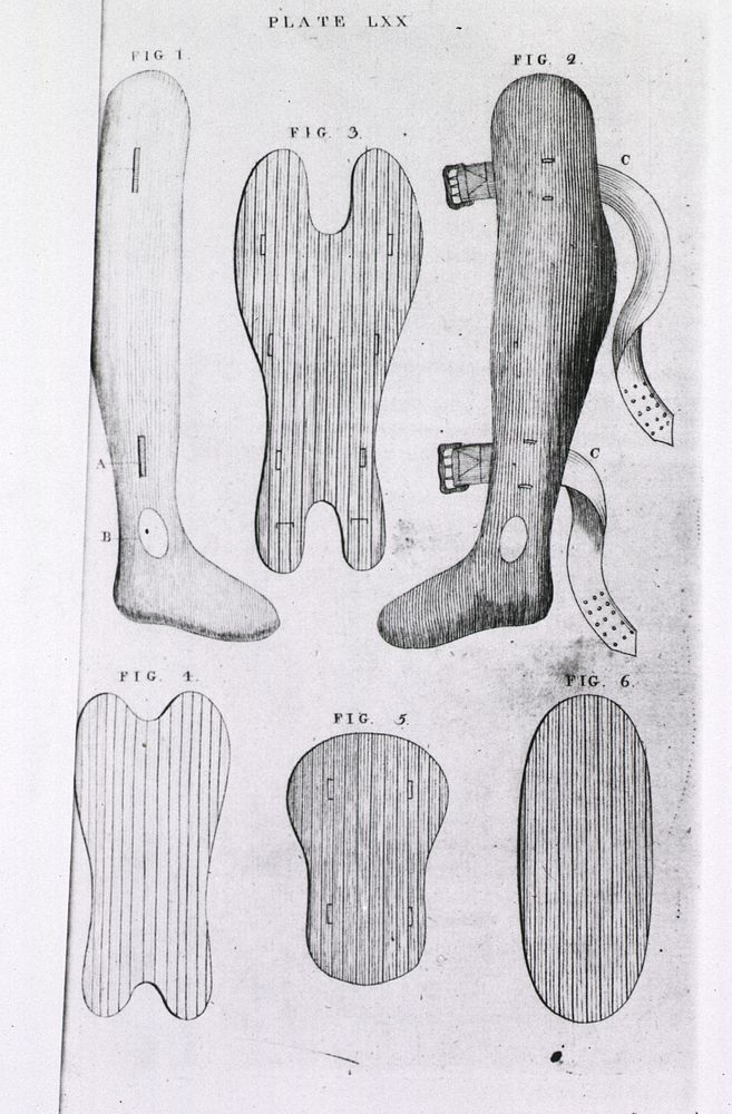 Orthopedic splints or bracesCollection: Images from the History of Medicine (IHM) Author(s): Bell, Benjamin, 1749-1806…