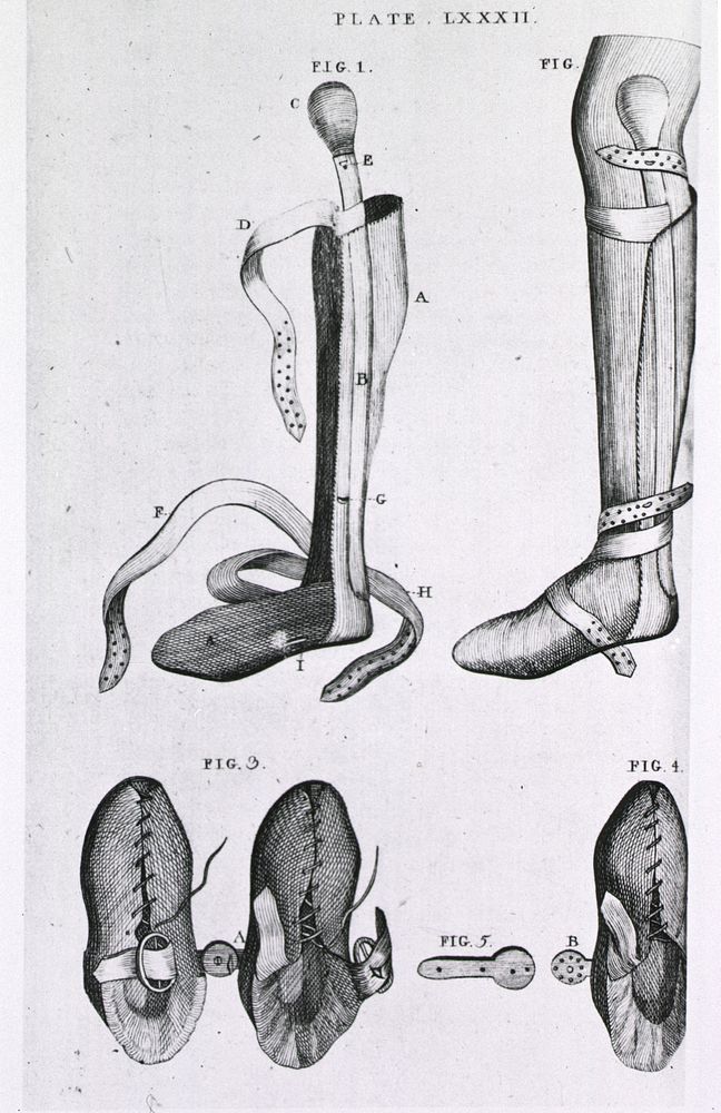 Leg braces and corrective shoesCollection:Images from the History of Medicine (IHM) Author(s):Bell, Benjamin, 1749-1806…