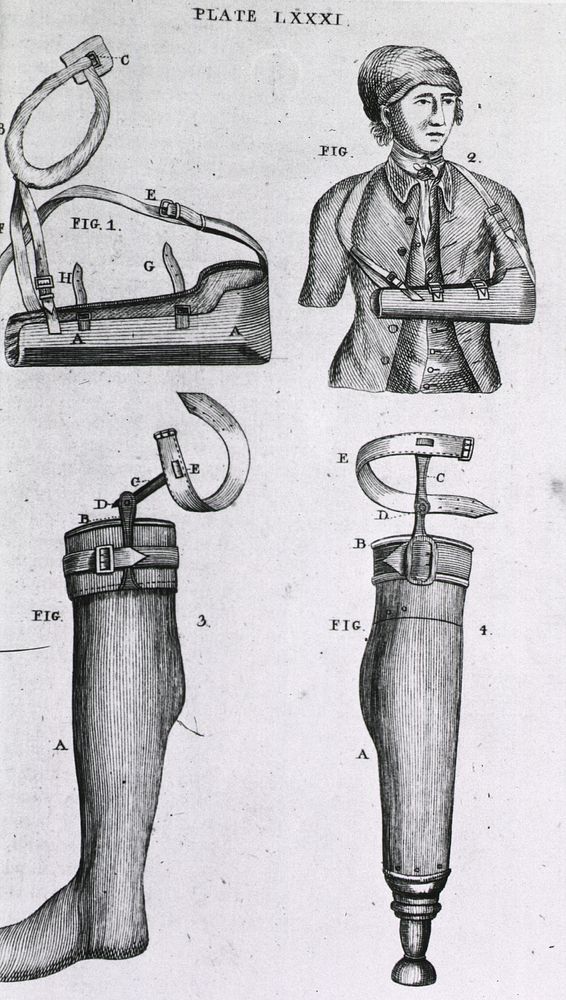 Arm sling and artificial legsCollection:Images from the History of Medicine (IHM) Author(s):Bell, Benjamin, 1749-1806…