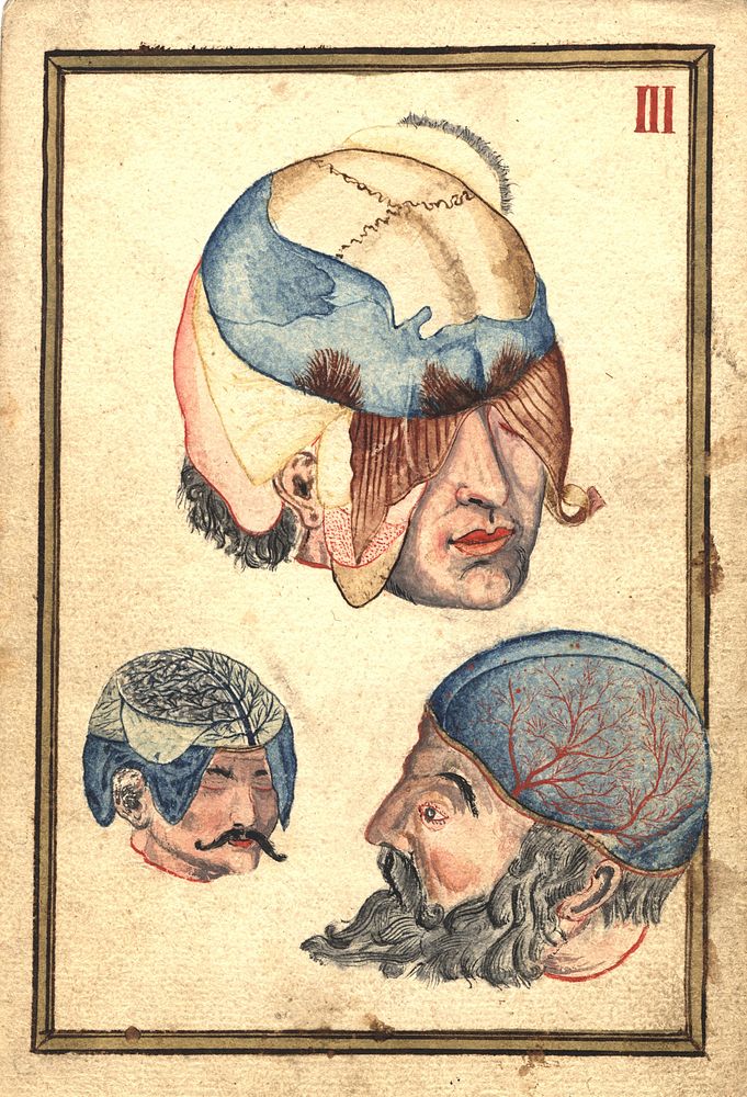Three Heads with Flayed Scalps, Showing Cranium and VeinsCollection:Images from the History of Medicine…