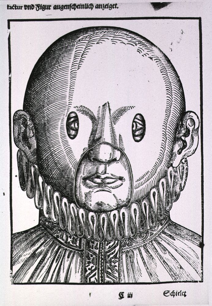 Treatment for strabismusCollection:Images from the History of Medicine (IHM) Author(s):Bartisch, George, 1535-approximately…