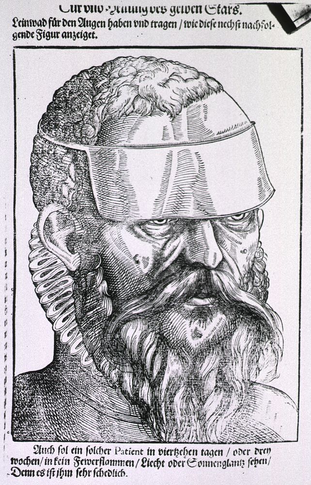 Man Wearing an EyeshadeCollection:Images from the History of Medicine (IHM) Author(s):Bartisch, George, 1535-approximately…