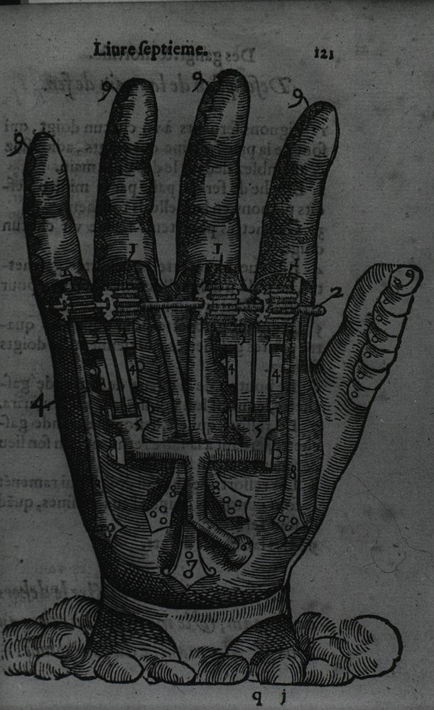 Artificial HandCollection:Images from the History of Medicine (IHM) Author(s):Paré, Ambroise, 1510?…