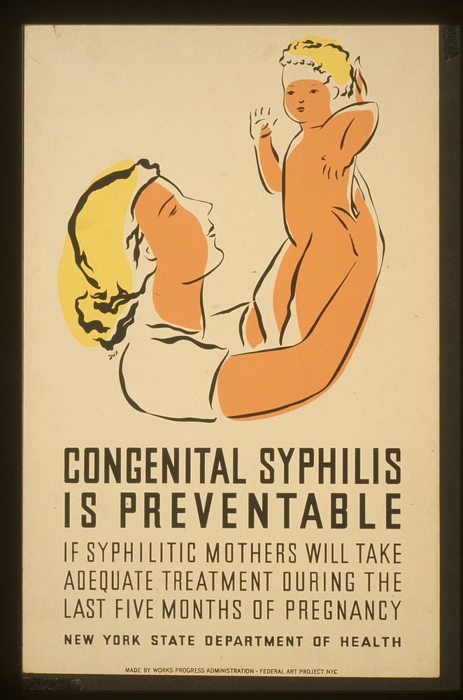 Congenital syphilis is preventable If syphilitic mothers will take adequate treatment during the last five months of…