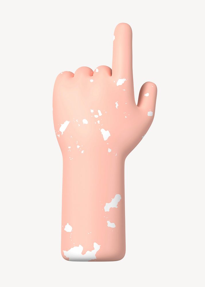 Finger-pointing hand gesture, vitiligo awareness, 3D illustration