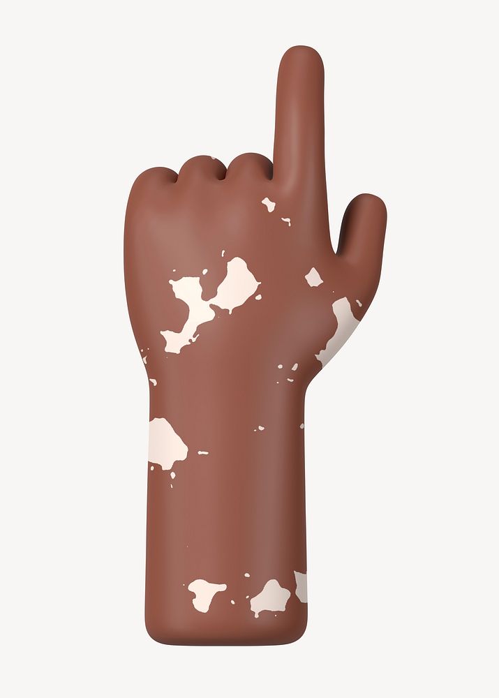 Finger-pointing hand gesture, vitiligo awareness, 3D illustration