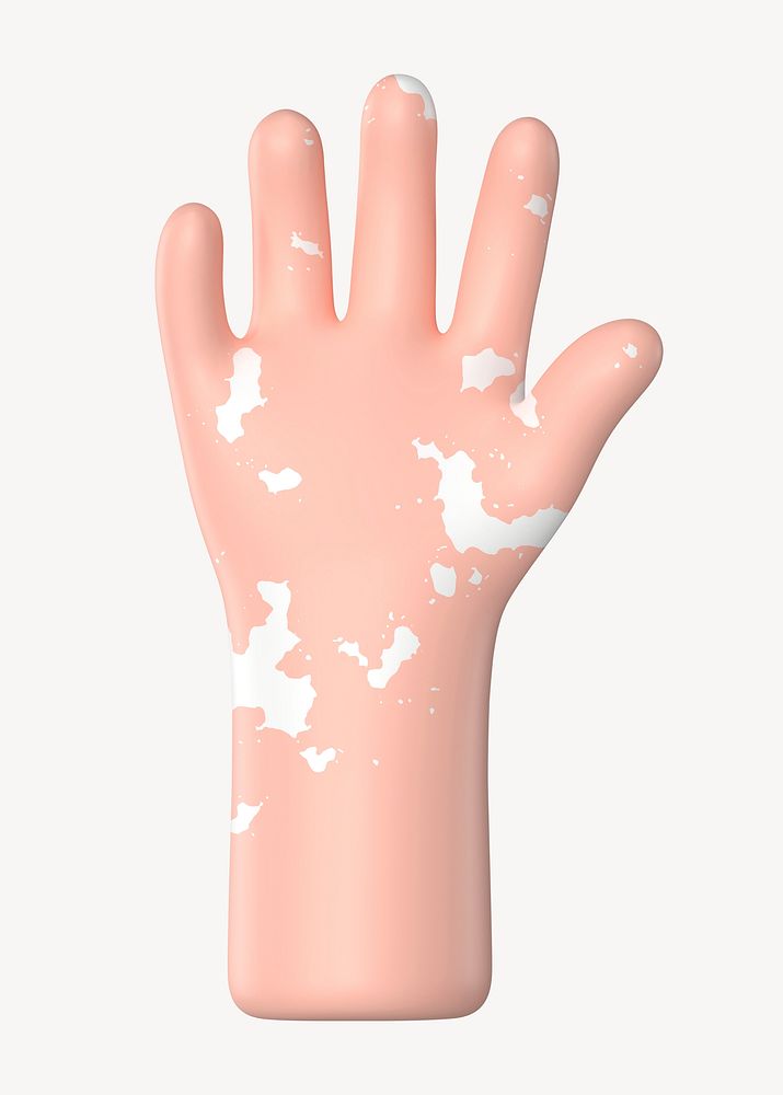 Raised vitiligo hand gesture, 3D illustration psd