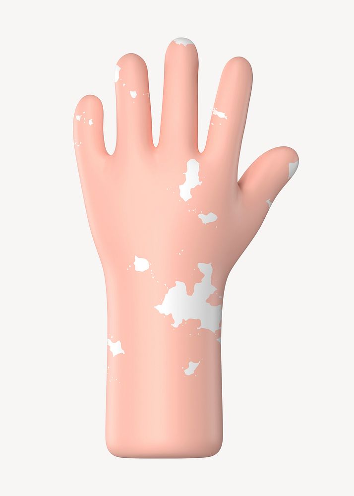 Raised vitiligo hand gesture, 3D illustration